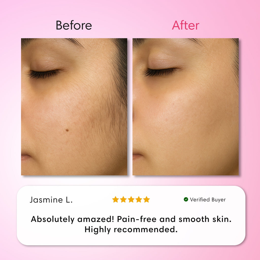 Hair Removal Trilogy Kit