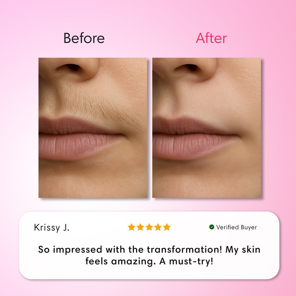 Hair Removal Trilogy Kit